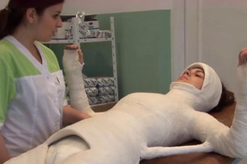 女子为减肥全身缠绷带 四年如木乃伊_百度视频搜索