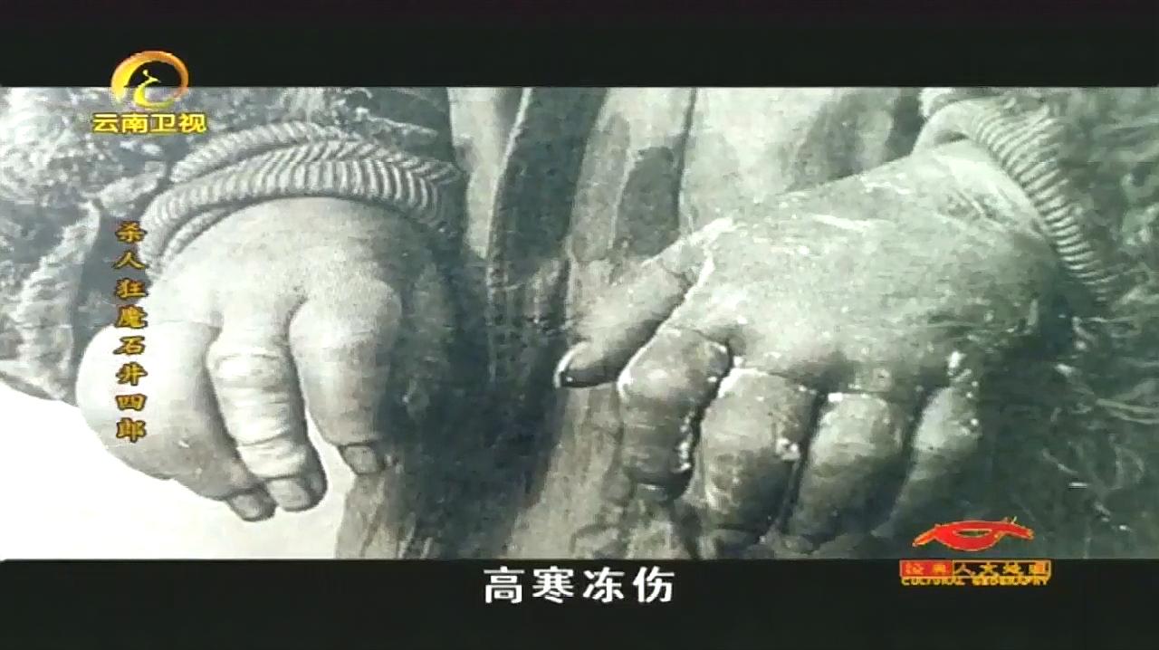 臭名昭著的731部队,拿中国人做冻伤实验,不断的往手脚上浇冰水