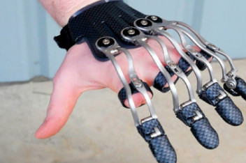 波兰发明假肢手造价低廉功能强 110217 中原午报_百度视频搜索