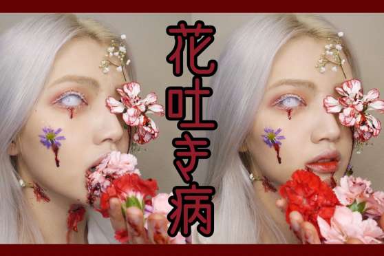 赤花症 百度 赤花症 百度